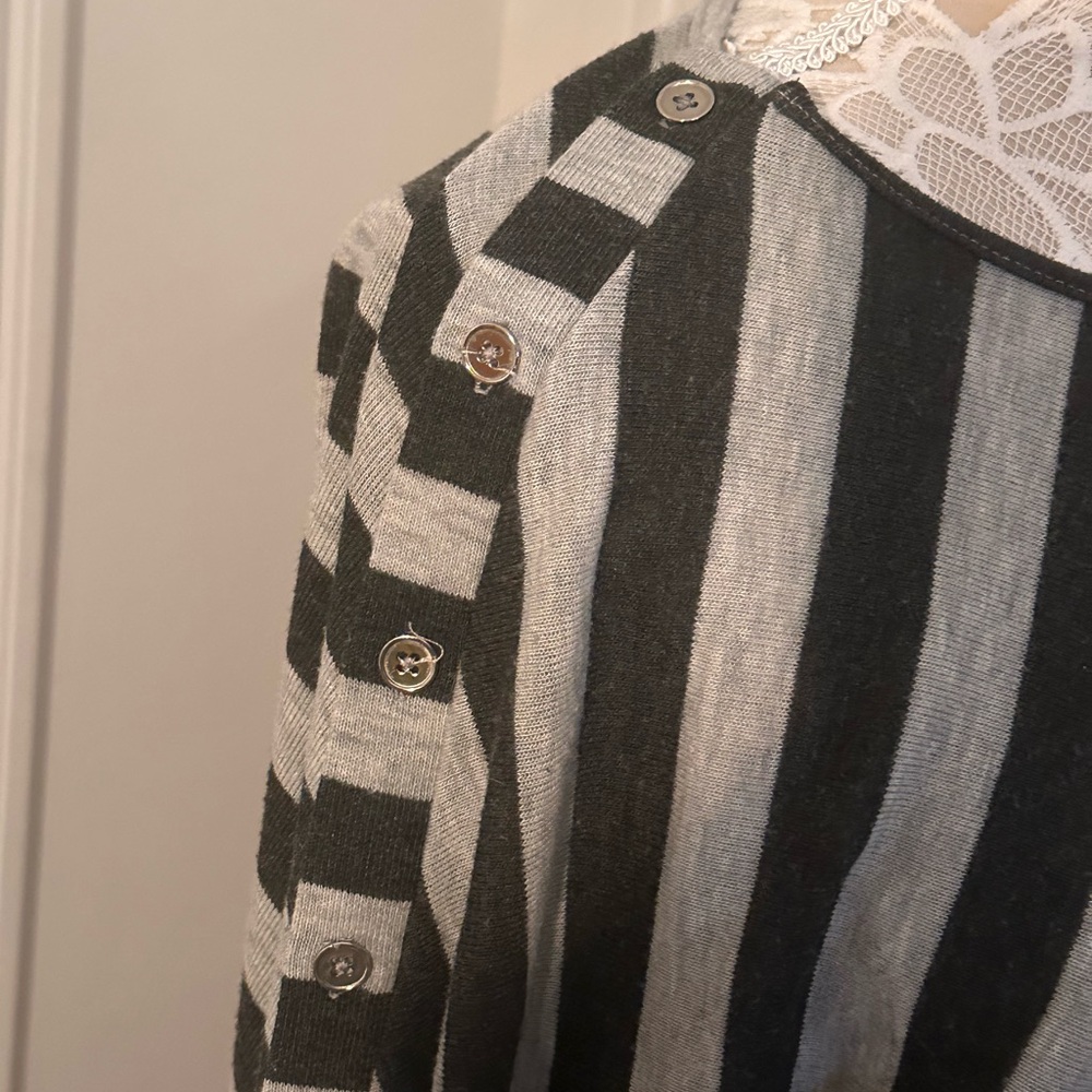 Super soft striped tunic dress button details